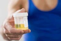 Penjelasan Kandungan Urine Yang Berwarna Kuning