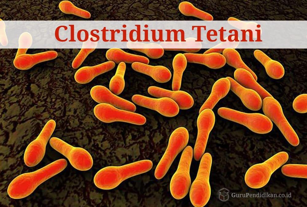 Bakteri clostridium tetanus dapat menyebabkan penyakit otot yang disebut